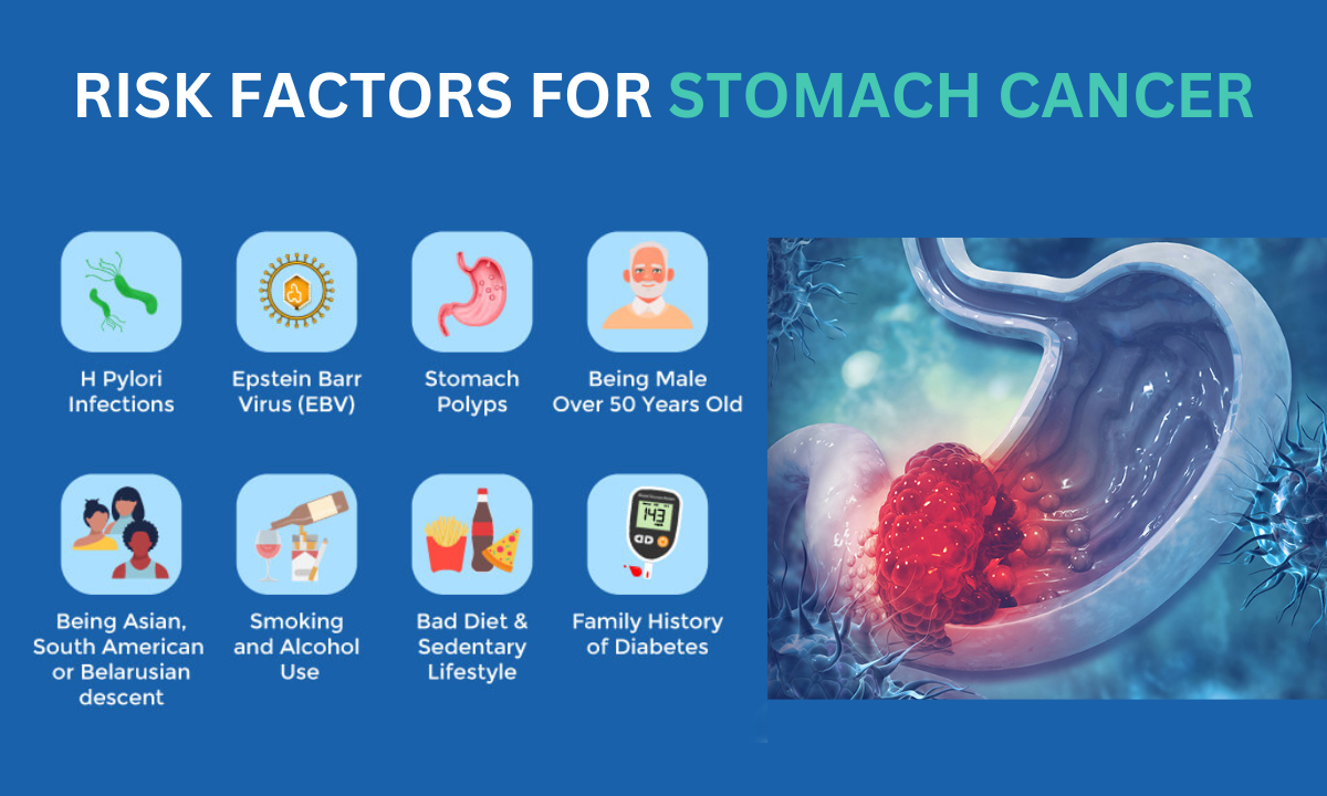 Risk Factors for stomach cancer